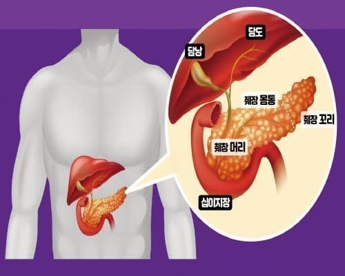매일 혹사당하는 췌장을 살리는 기술