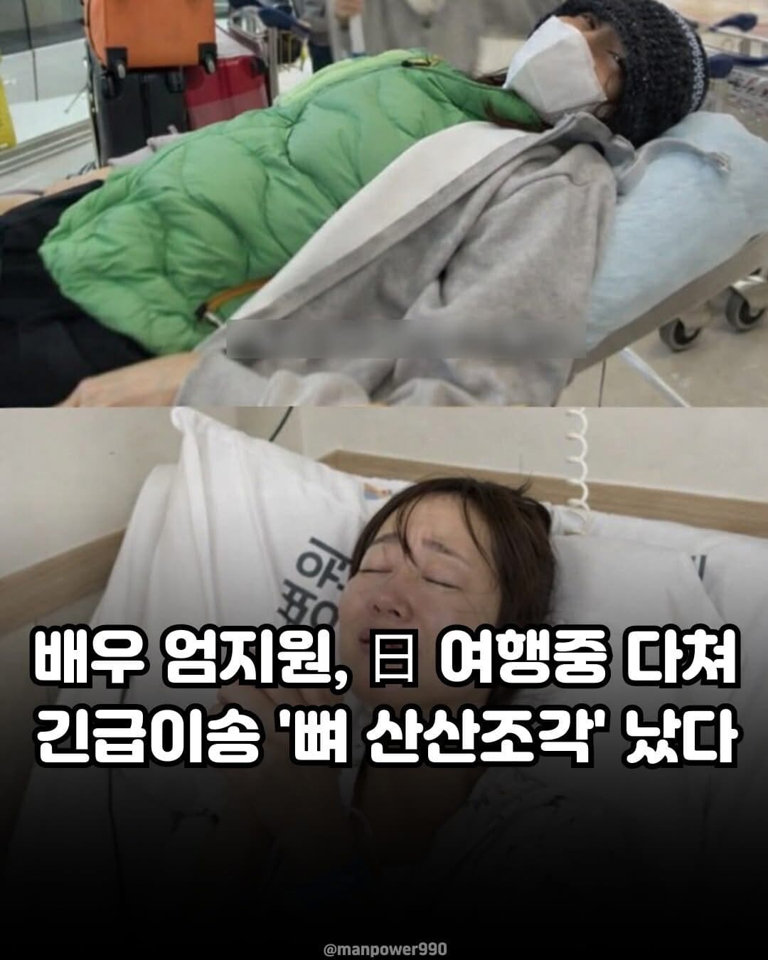 배우 암지원 일본여행중 뼈 산산조작 남