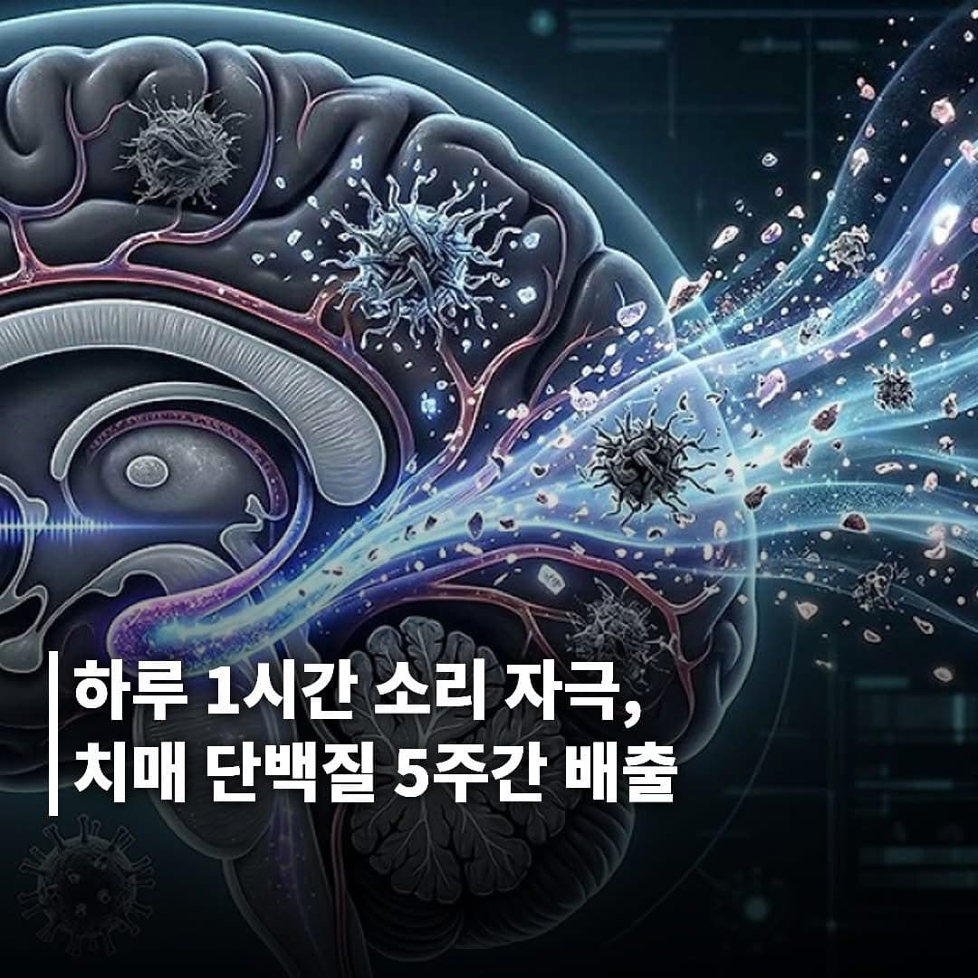 하루 1시간 소리 자극으로 치매 단백질 200% 배출…5주간 효과 지속